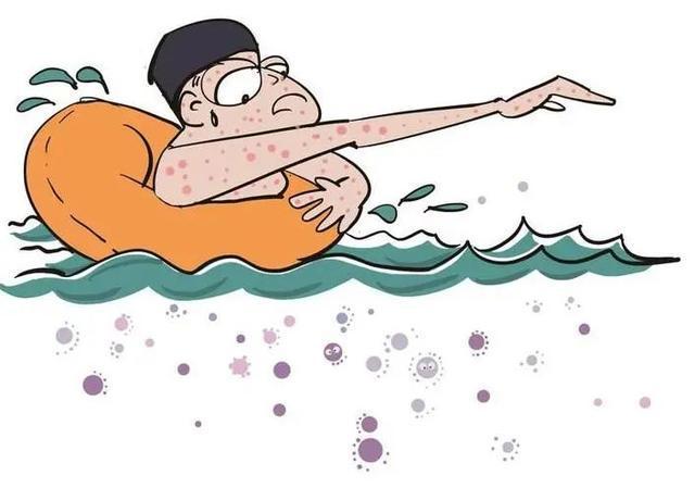 1750127031498211.jpeg 游泳池細菌2.jpeg